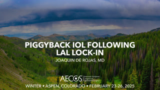 Case: Piggyback IOL following LAL lock-in